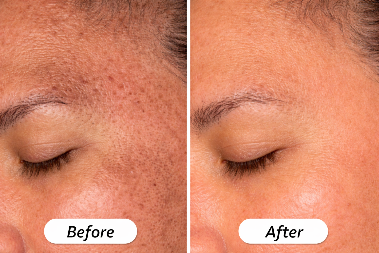 Dermatology screening consultation